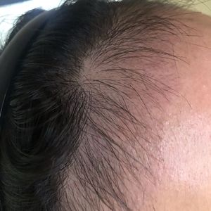 发际线分享社区