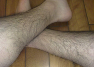 腿毛种植能长出腿毛吗 术后应该怎么护理