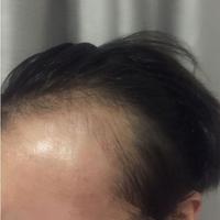 發(fā)際線用戶圖片
