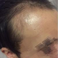 發(fā)際線用戶圖片