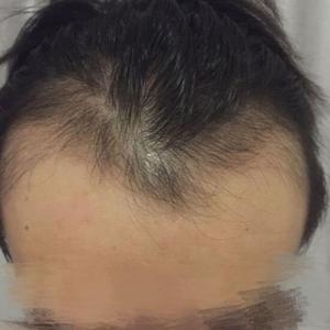 发际线分享社区