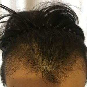 发际线分享社区