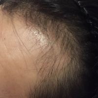 發(fā)際線用戶圖片