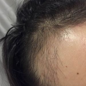 发际线分享社区