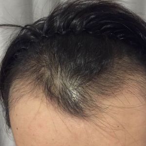 发际线分享社区