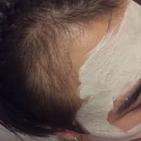 發(fā)際線用戶圖片