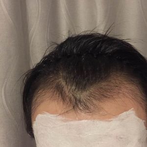 发际线分享社区