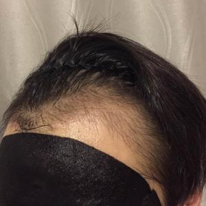 发际线分享社区