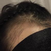 發(fā)際線用戶圖片