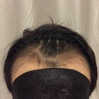 發(fā)際線用戶圖片
