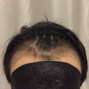 发际线分享社区
