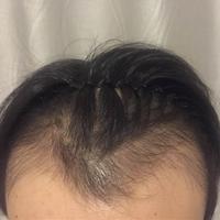 發(fā)際線用戶圖片