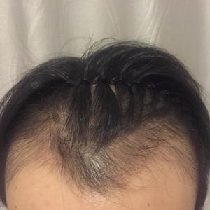发际线分享社区