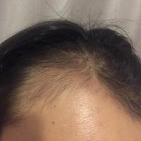發(fā)際線用戶圖片