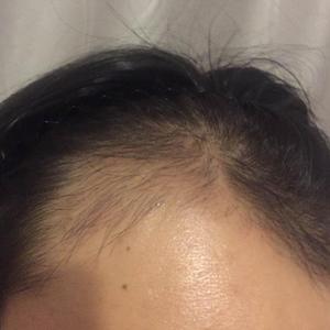 发际线分享社区