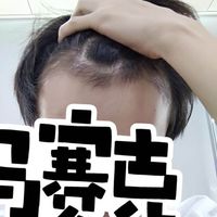 發(fā)際線用戶圖片