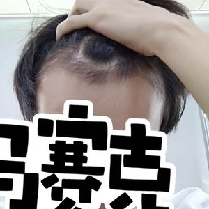 发际线分享社区