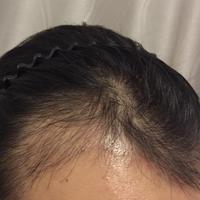 發(fā)際線用戶圖片