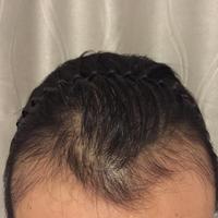 發(fā)際線用戶圖片