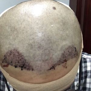 发际线分享社区