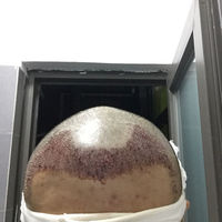發(fā)際線用戶圖片