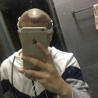 發(fā)際線用戶圖片
