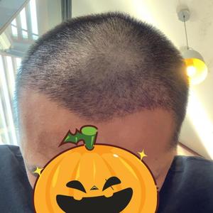 发际线分享社区