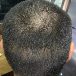 发际线分享社区