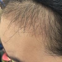 發(fā)際線用戶圖片