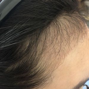 发际线分享社区