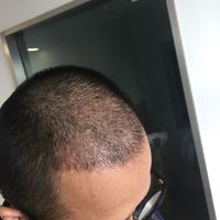 發(fā)際線用戶圖片
