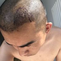發(fā)際線用戶圖片