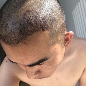 发际线分享社区