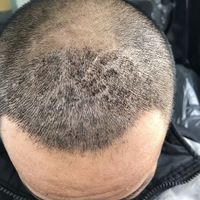 發(fā)際線用戶圖片