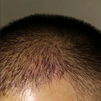 發(fā)際線用戶圖片