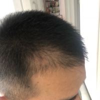 發(fā)際線用戶圖片