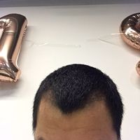 發(fā)際線用戶圖片