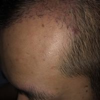 發(fā)際線用戶圖片