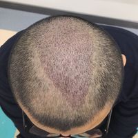 發(fā)際線用戶圖片
