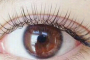 睫毛移植会让眼睛发炎吗 种植睫毛的优缺点是什么
