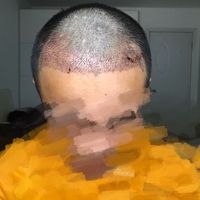 發(fā)際線用戶圖片