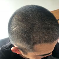 發(fā)際線用戶圖片