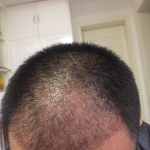 发际线分享社区