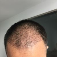 發(fā)際線用戶圖片