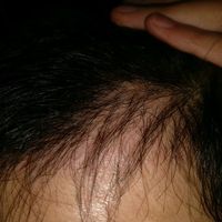 發(fā)際線用戶圖片