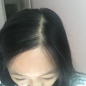 发际线分享社区