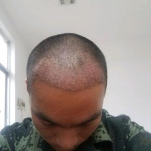 发际线分享社区