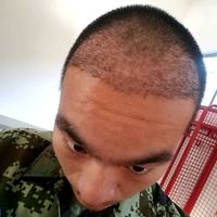 發(fā)際線用戶圖片