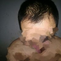 發(fā)際線用戶圖片