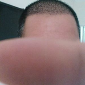 发际线分享社区